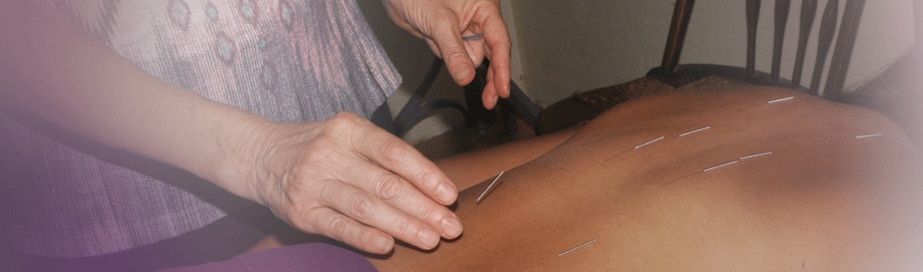 Japanese Acupuncture